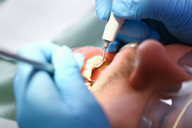 Best Emergency Denture Repair in Kings Grant, NC