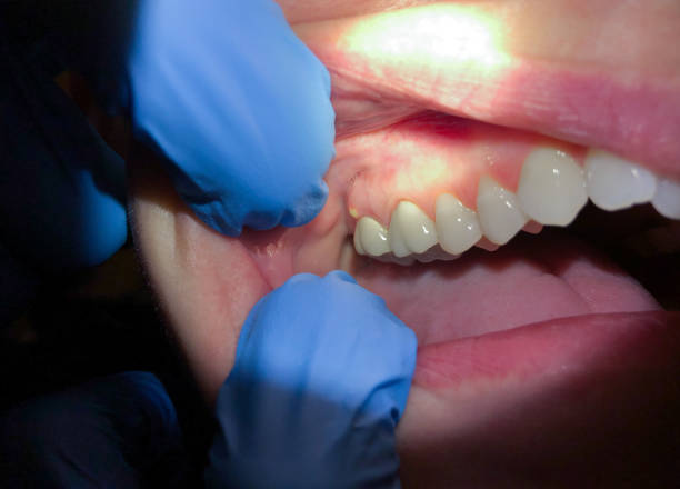 Best After-Hours Dental Trauma Care in Kings Grant, NC