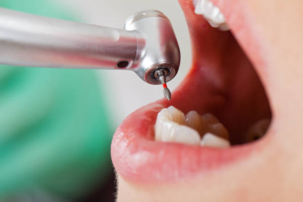 Best Emergency Tooth Extraction in Kings Grant, NC
